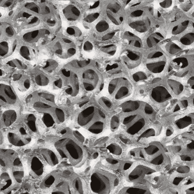 metal-foam